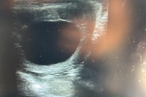 Ultrasound 2026-05-04