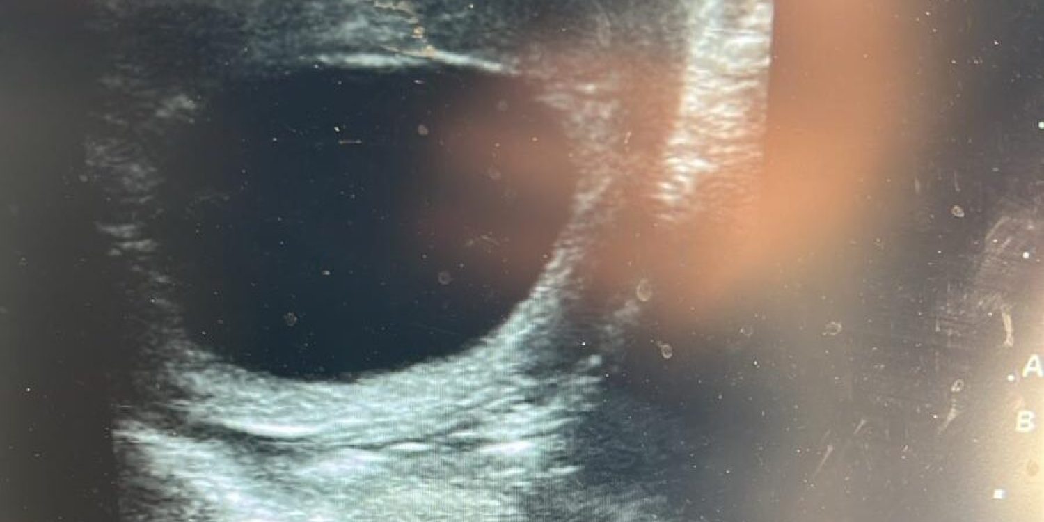 Ultrasound 2026-05-04